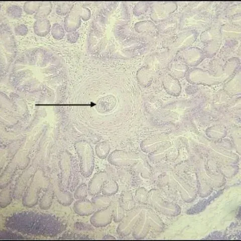 thumbnail for publication: Introduction to Infectious Diseases in Hard Clams